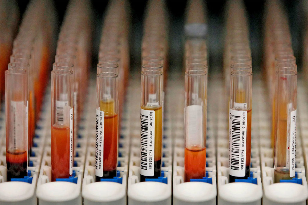 Test tubes